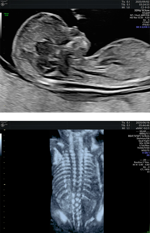 FMF精密初期胎児ドック｜新宿南口レディースクリニック 出生前検査