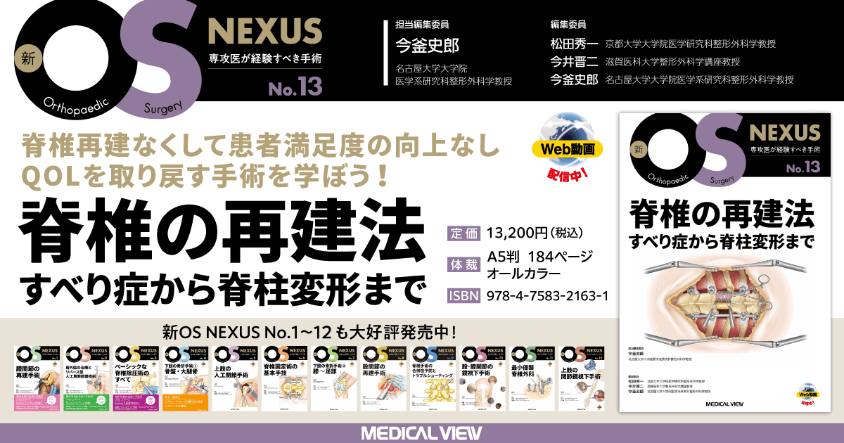 メジカルビュー社｜整形外科｜新OS NEXUS No.13 脊椎の再建法—すべり症