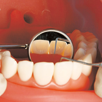 シンプルマネキンⅢチェアマウントセット｜株式会社ニッシン｜歯科模型