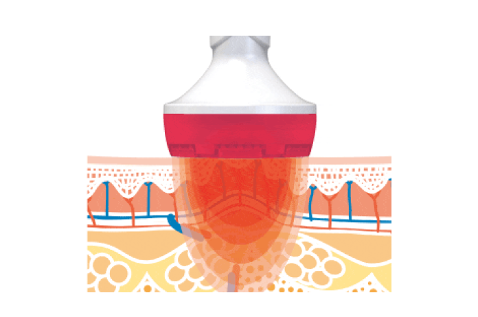CELLTUNE(セルチューン) | 電子運動器・美容器 | 伊藤超短波 一般の