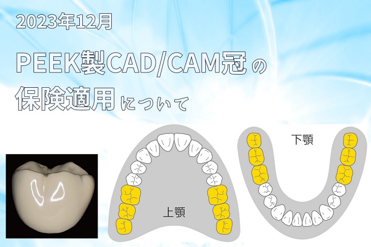 2023年12月 PEEK製CAD/CAM冠の保険適用について | Y-News