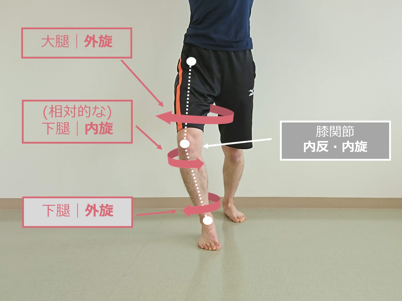 Knee-out&Toe-in(KOTI) により生じる膝関節へのメカニカルストレスと