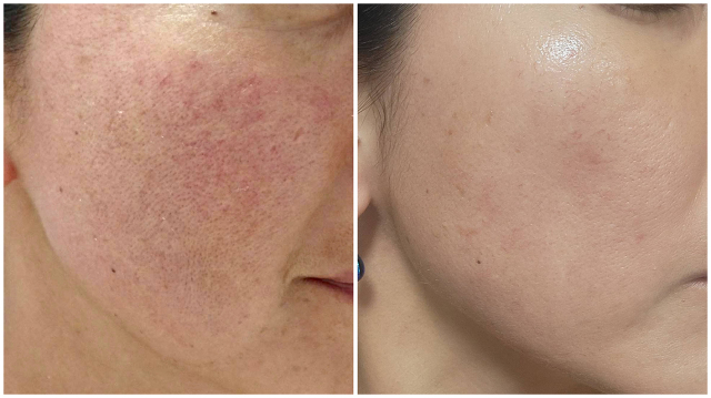 プリマトリーチェ