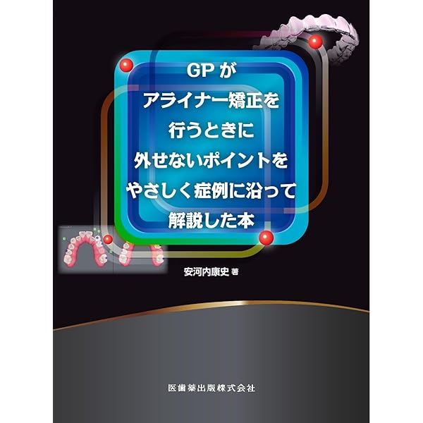 アライナージェネレーション: Dr. 尾島賢治のテクニック&分析ポイント