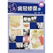 Amazon.co.jp: 必ず上達 歯冠修復(上) : 萩原 芳幸: 本