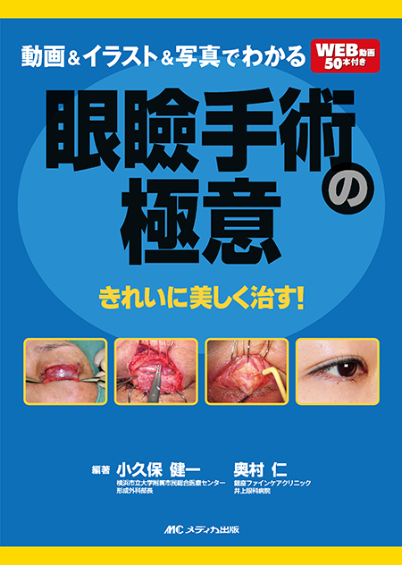 m3電子書籍 | 専修医 石嶋くんの眼瞼手術チャレンジノート