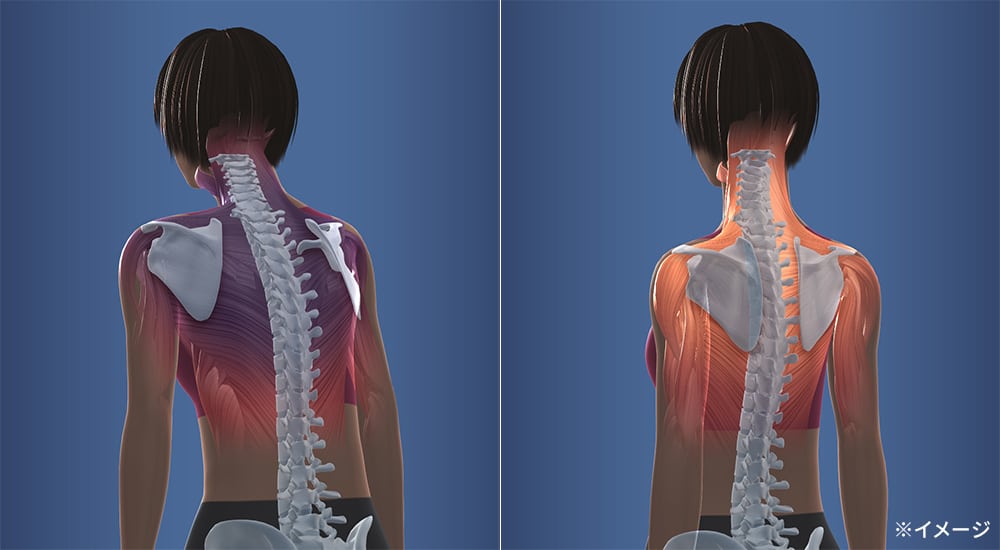 スリムビューティPAD（パッド） 通販 - ディノス