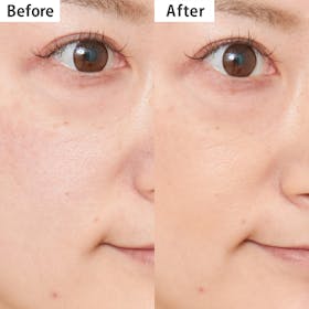 フレッシェル スキンケアBBクリーム（EX） ミディアムベージュを