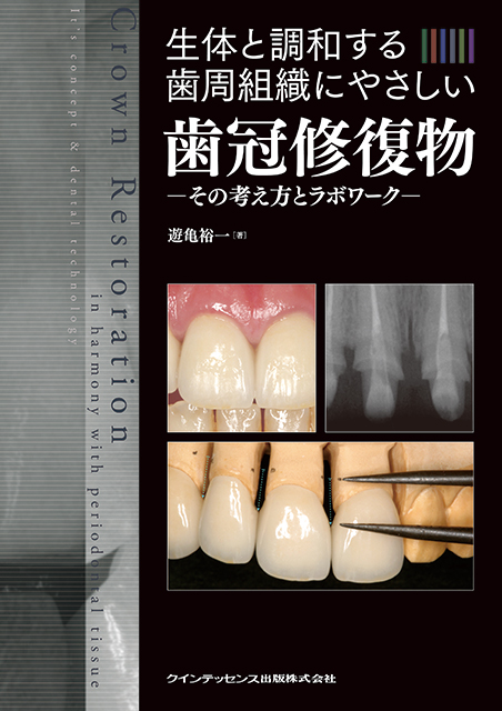 裁断済み 歯冠修復 上・下 セット 裁断済み】必ず上達歯冠修復上・下