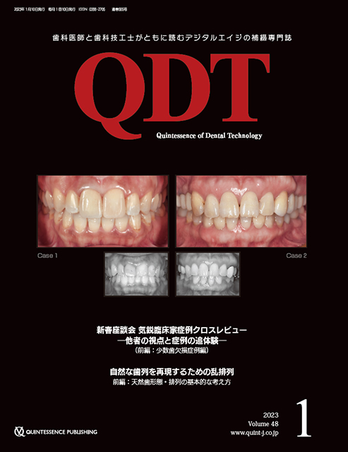 インプラント周囲炎ゼロコンセプト - クインテッセンス出版
