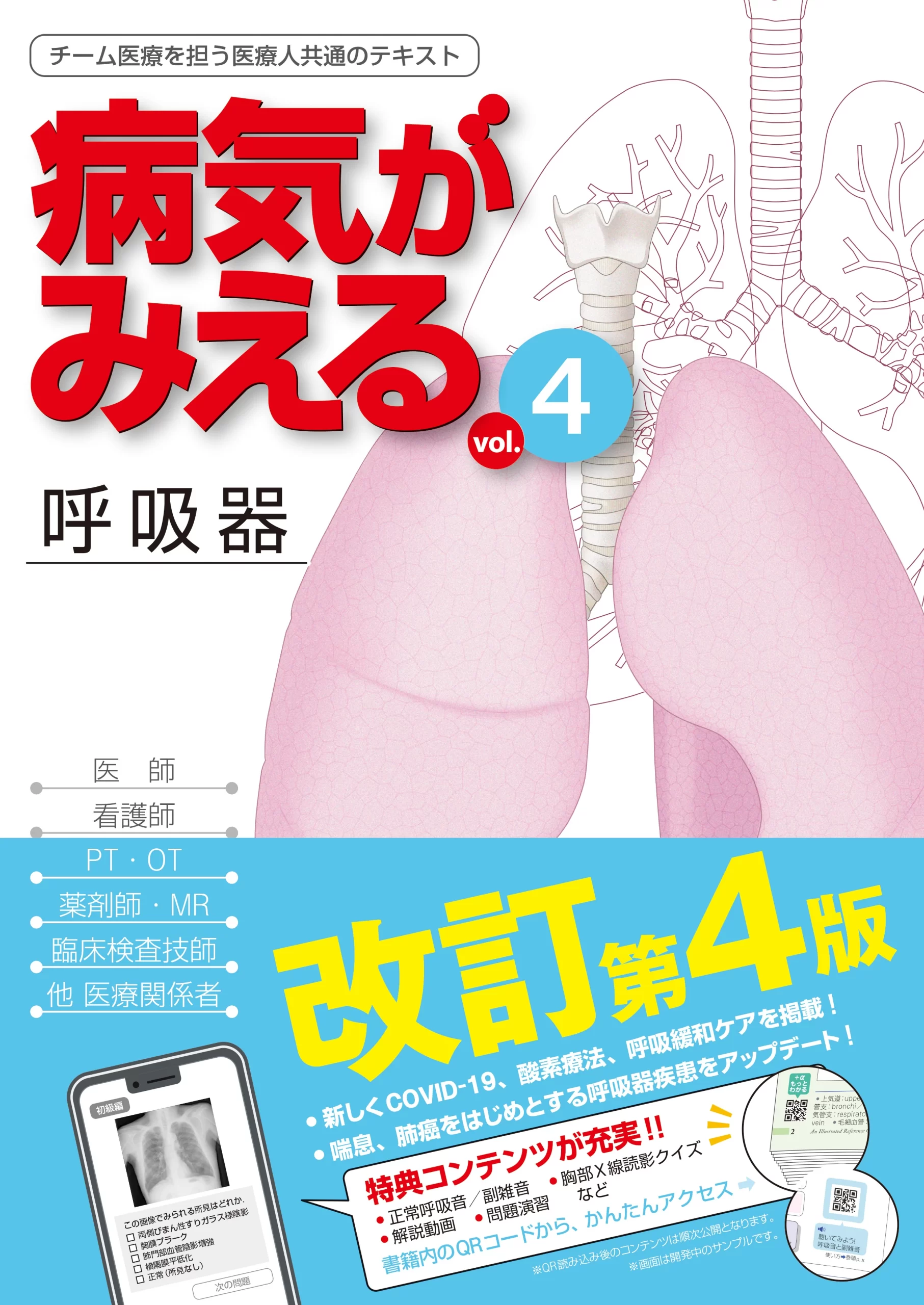 新刊（改訂版）］『病気がみえるvol.4 呼吸器（第4版）』 2025年3月4日
