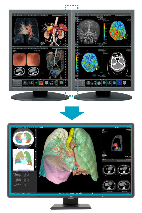 800万画素32型カラー液晶モニター JESRA X-0093(管理グレード1B)対応