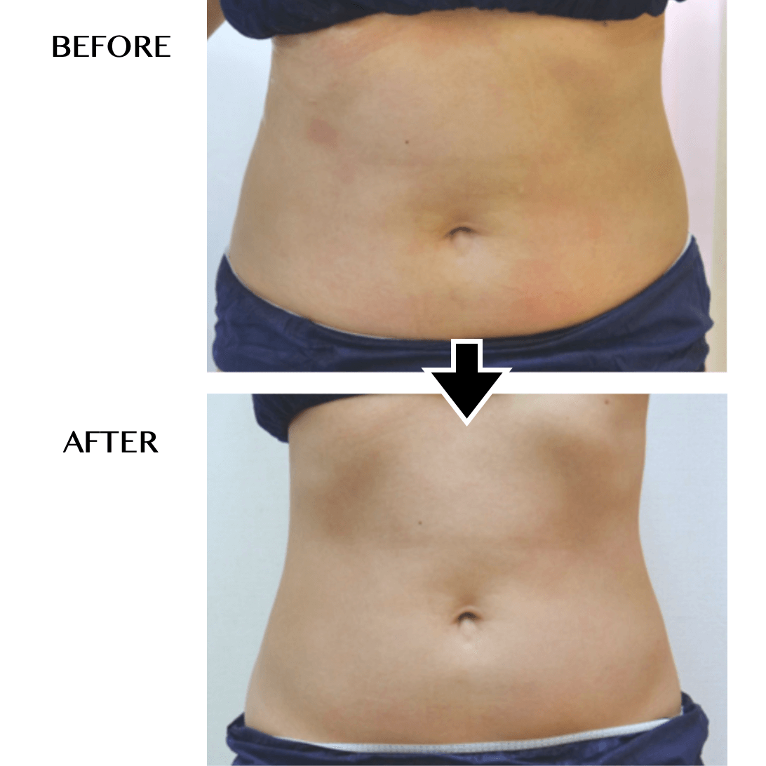 CELLZERO FAST | 「じぶんdeエステ」オンラインショップ【公式】 セル