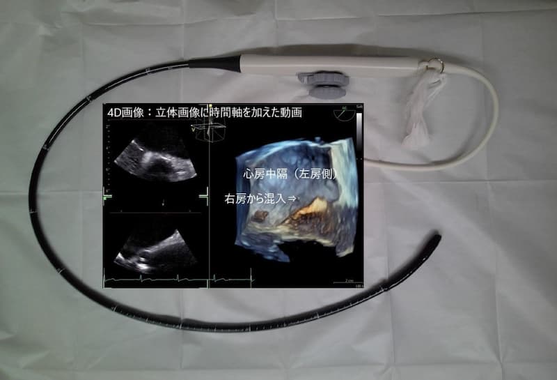 経食道心エコー図検査 | 病院概要 | 沼田脳神経外科循環器科病院