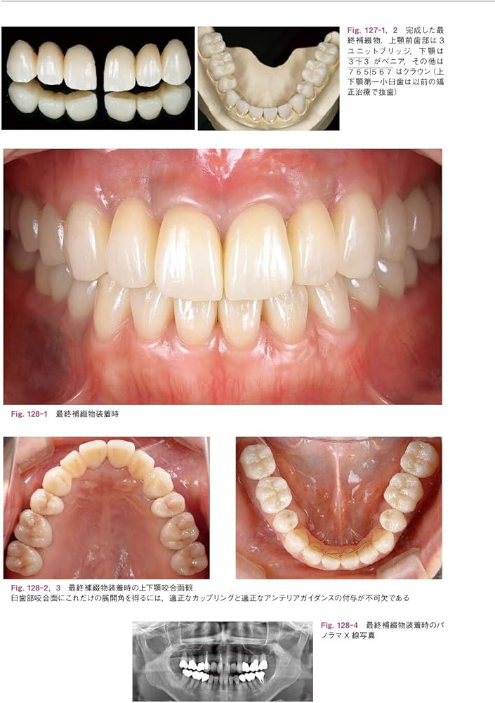 包括的治療戦略 Vol.2 for Functional Management | 土屋 賢司 |本
