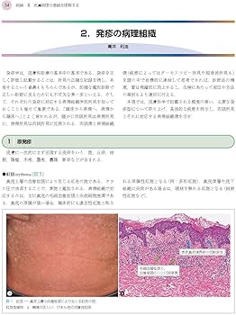 71Lyngg9fBL._AC_UF350,