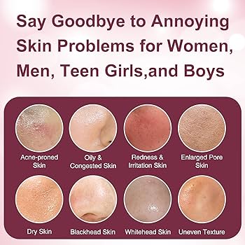 Amazon.com: Skin Care Set, 6pcs Women Girls Skin Care for Teens 10