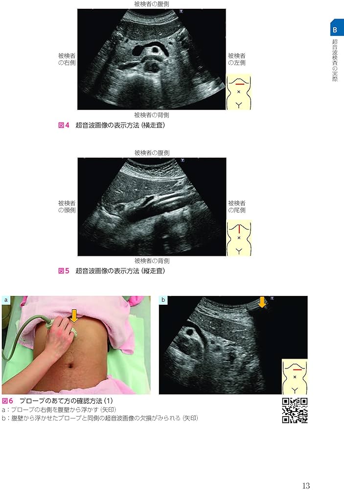 Dr 森の腹部超音波診断パーフェクト premium movie version 改訂第2版