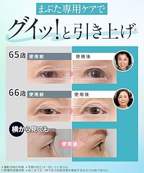 Amazon.co.jp: 北の快適工房 リッドキララ : ビューティー