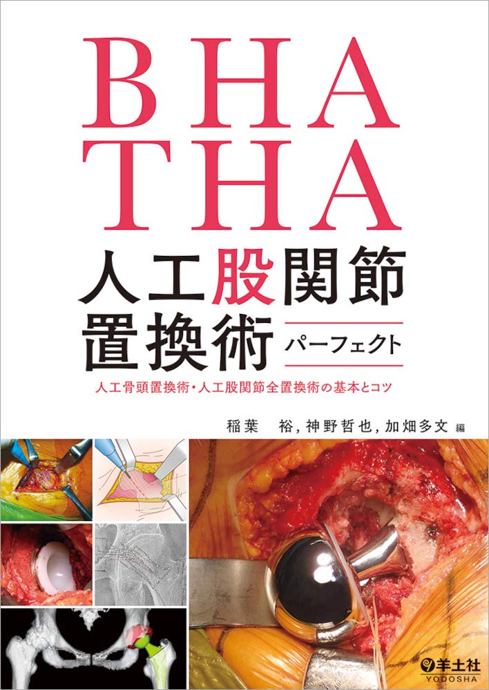 BHA・THA 人工股関節置換術パーフェクト〜人工骨頭置換術・人工股関節