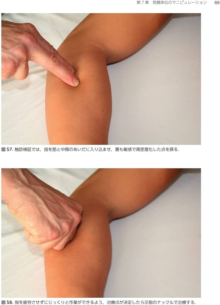 Amazon.co.jp: 筋膜マニピュレーション 理論編 原著第2版: 筋骨格系