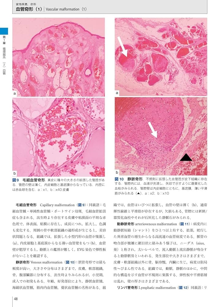 カラーアトラス 病理組織の見方と鑑別診断 第7版 | 赤木 忠厚, 松原 修