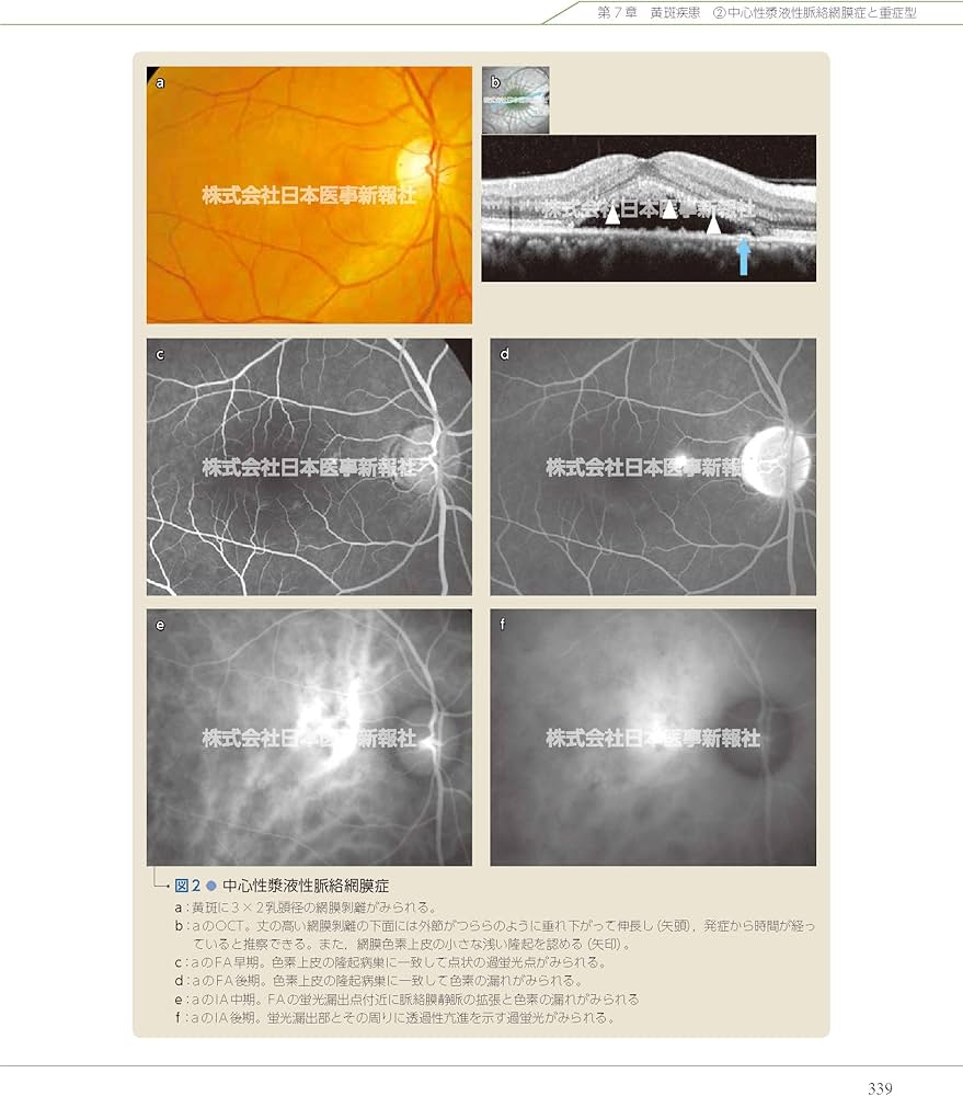 カラーアトラス眼底図譜 | 湯澤美都子, 川村昭之, 森隆三郎 |本 | 通販