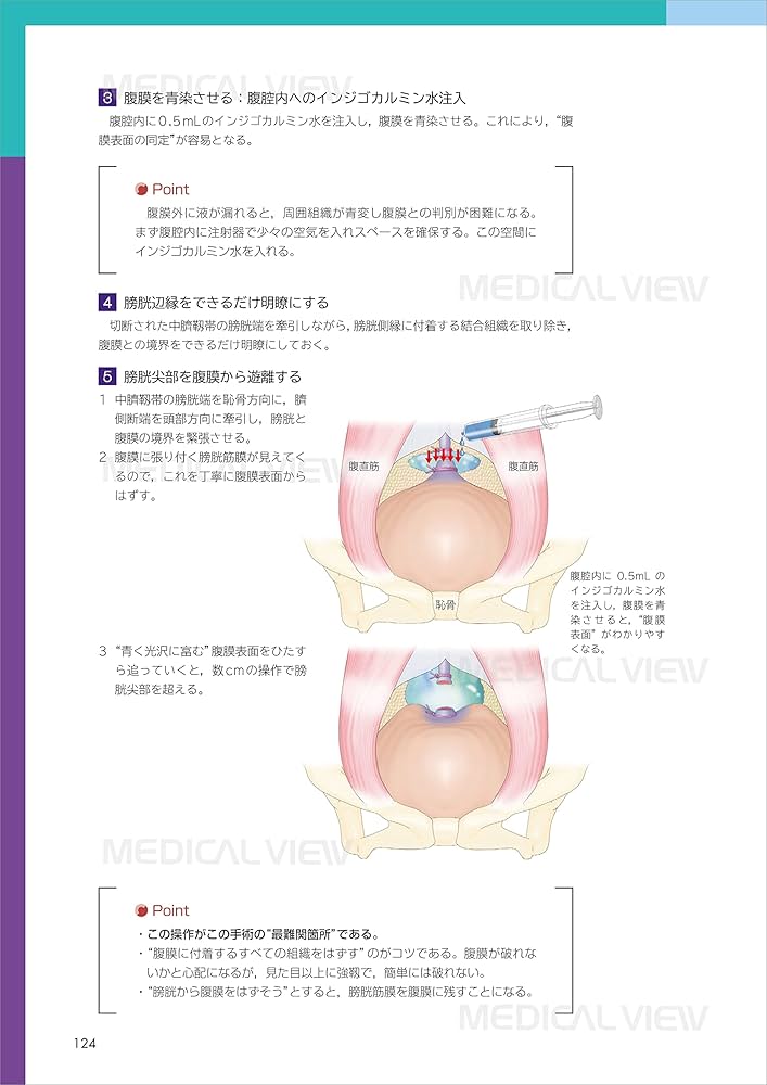 Amazon.co.jp: いきなり帝王切開術−局所解剖を熟知し,コツを盗もう