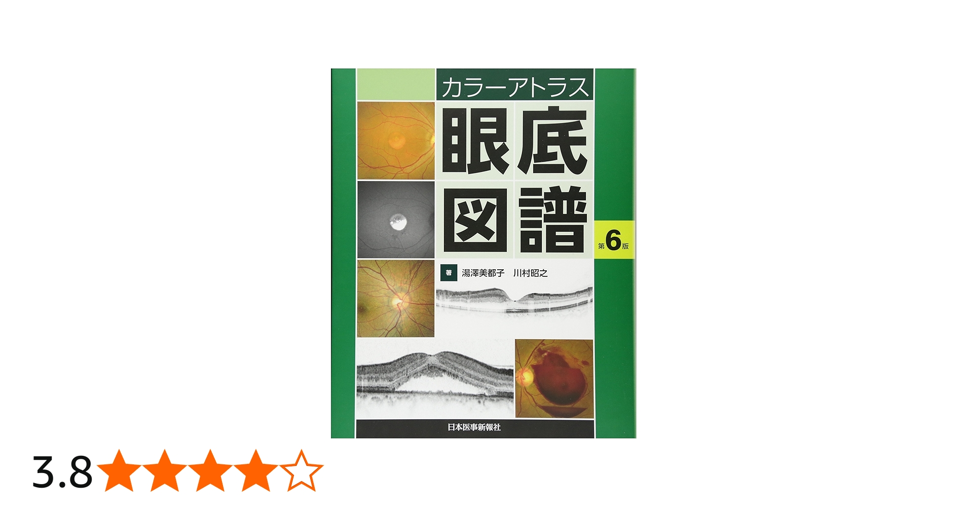 カラーアトラス 眼底図譜 | 湯澤美都子, 川村昭之 |本 | 通販 | Amazon