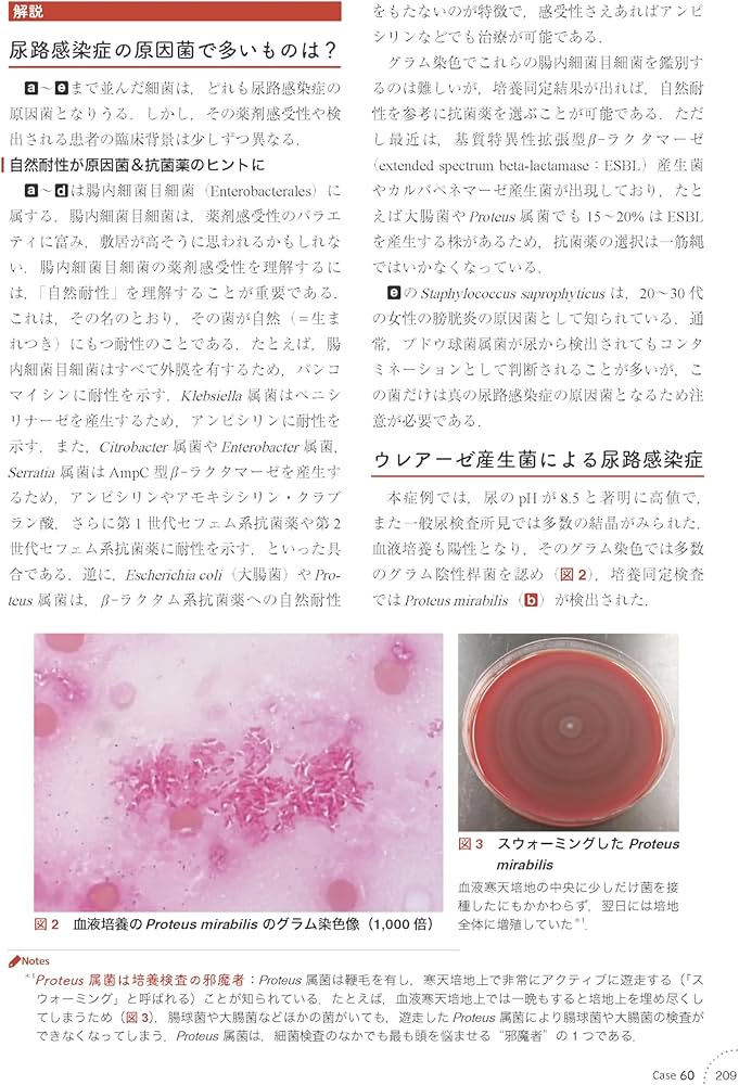 感染症内科ドリル WEB版付: みるトレ決定版 | 笠原 敬, 忽那 賢志