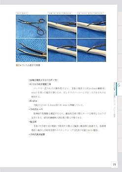整形外科レジデントのための上肢のベーシック手術 | 田中利和 |本