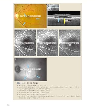 カラーアトラス眼底図譜 | 湯澤美都子, 川村昭之, 森隆三郎 |本 | 通販