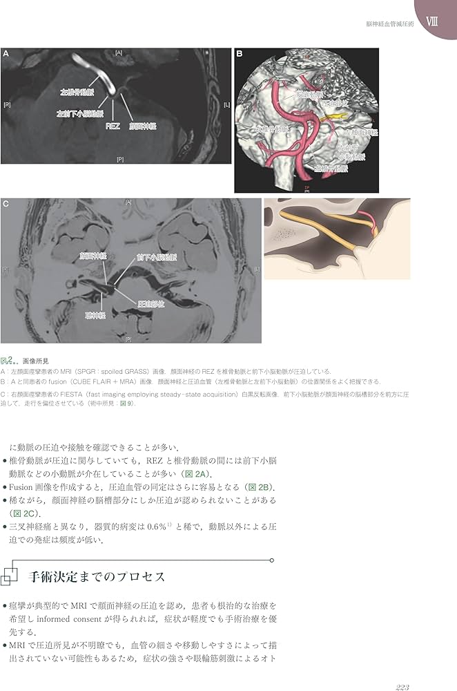 Amazon.co.jp: プライム脳神経外科6 機能外科的疾患 (プライム脳神経