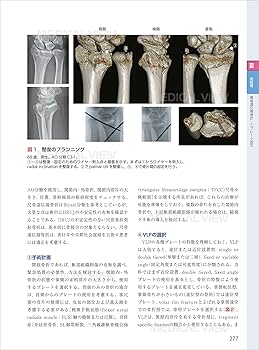 スタンダード骨折手術治療 上肢 | 渡部 欣忍 |本 | 通販 | Amazon