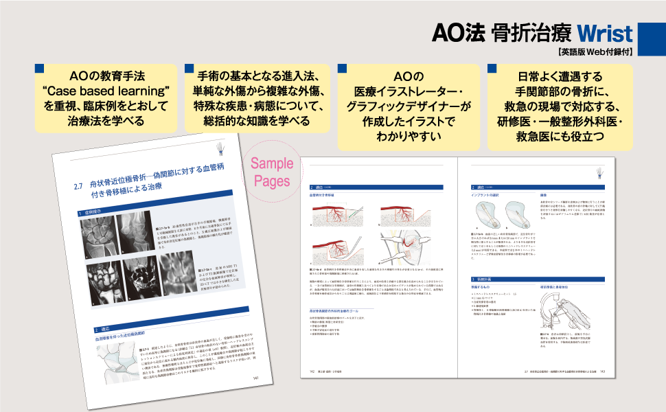 AO法骨折治療 Wrist: 英語版Web付録付 (AOTRAUMA) | 田中 正, 金谷