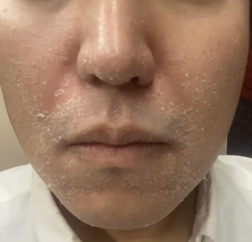 ゼオスキンセラピューティックコースをコスパよく受けるためのポイント