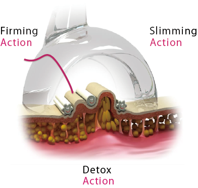 STARVAC DX smart 本体 | 誠鋼社 SEIKOSHA 美容・エステサロン