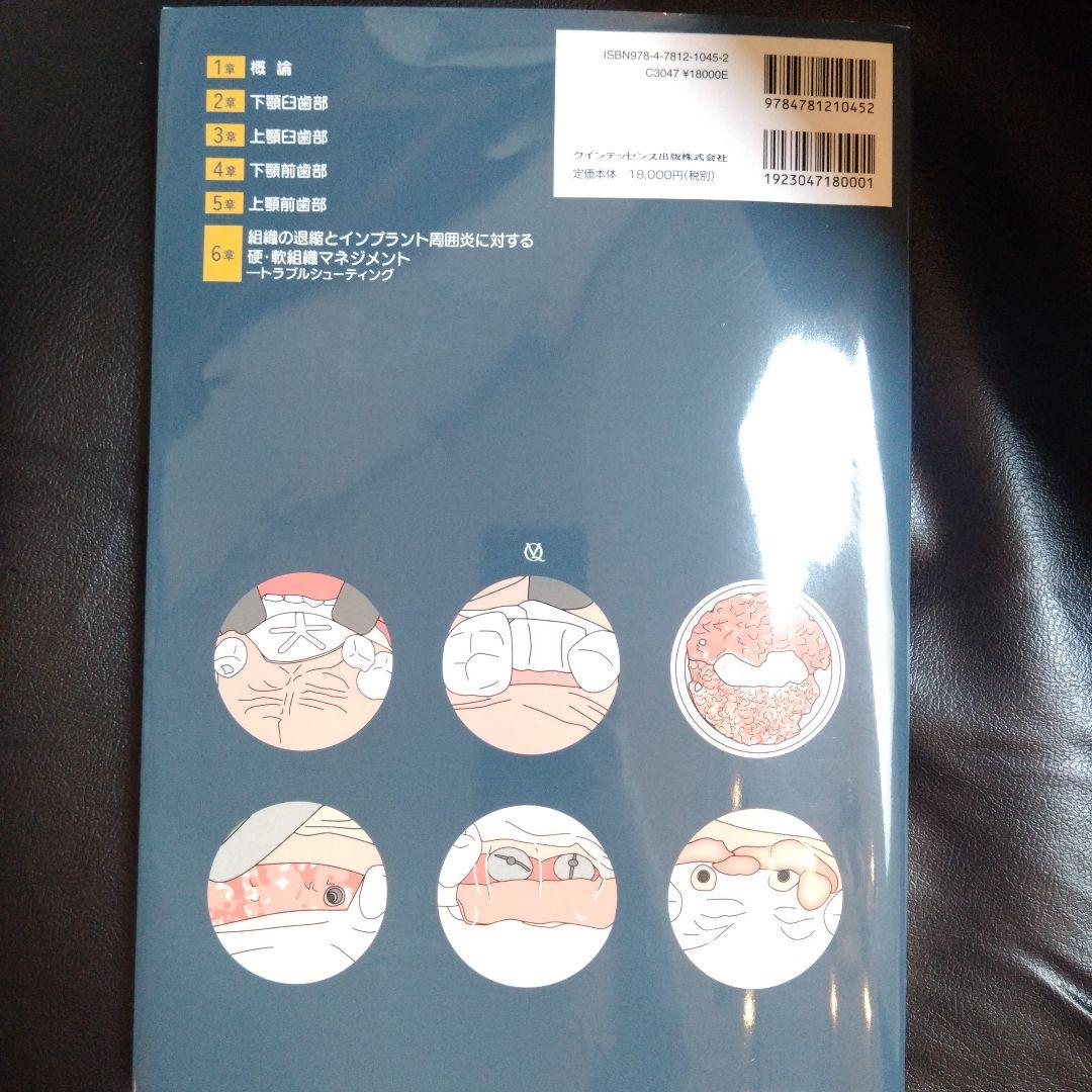 硬・軟組織マネジメント大全 インプラント 歯科 クインテッセンス出版