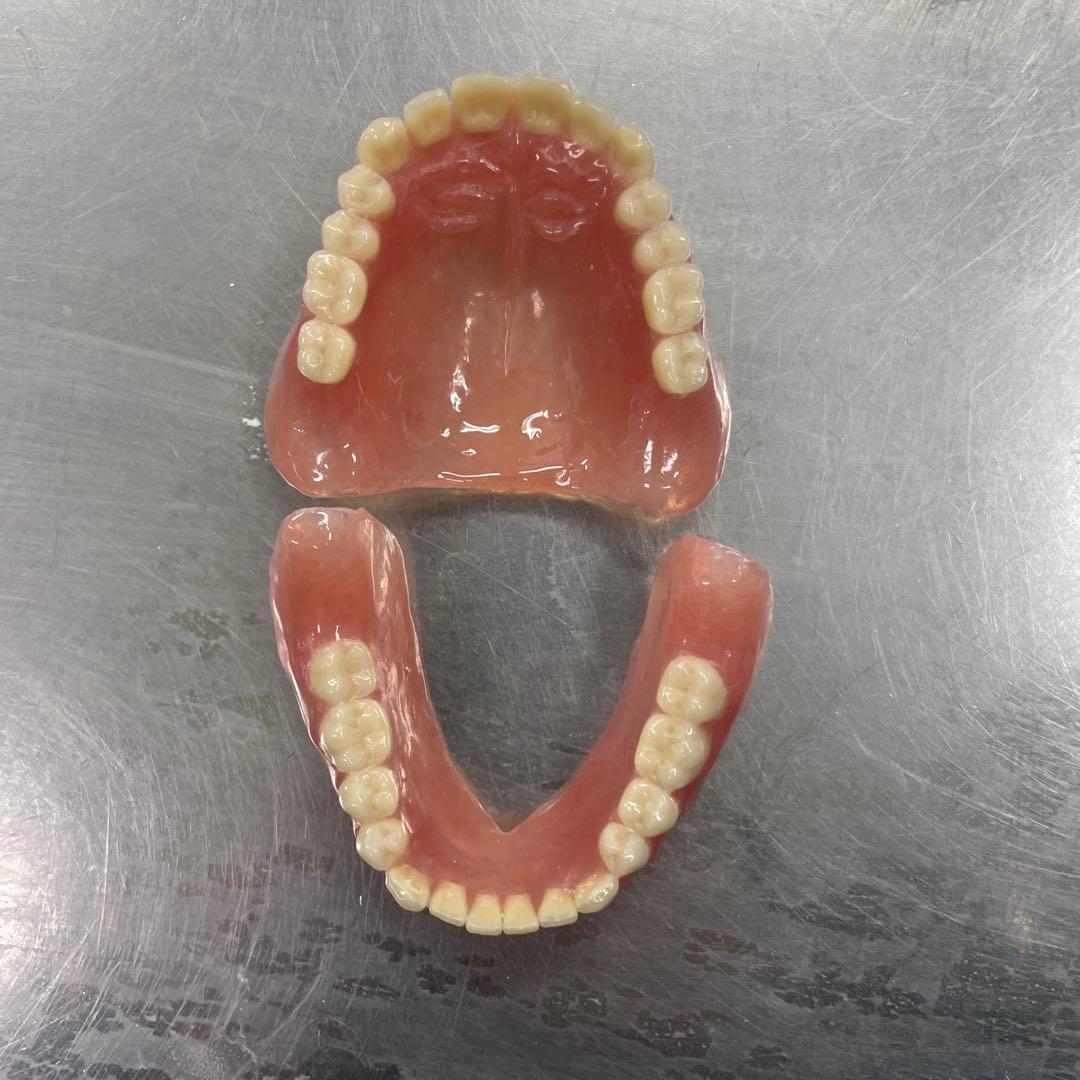 義歯 見本 総義歯 入れ歯 全部床義歯 歯科 ばんばんざい義歯