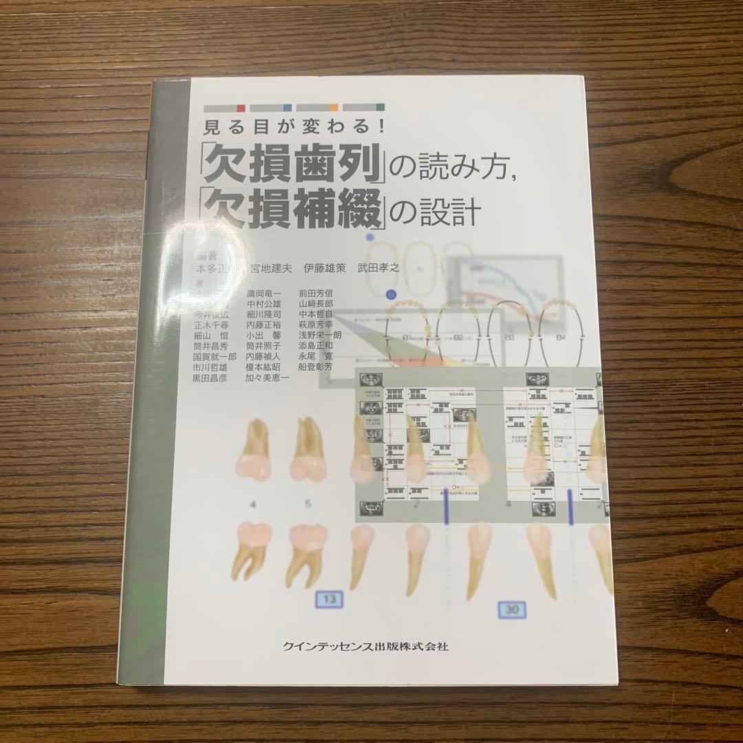 見る目が変わる!「欠損歯列」の読み方,「欠損補綴」の設計 見る目が変わる！ 「欠損歯列」の読み方，「欠損補綴」の設計