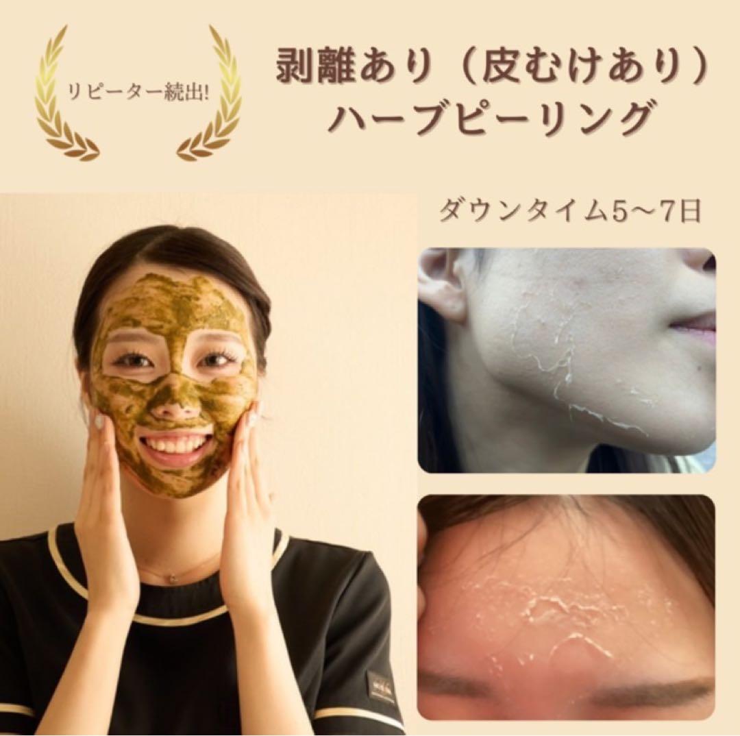 T.R Savings 剥離ありハーブピーリング10回分 ハーブピーリング 剥離あり 皮向けあり 10回分→10g - メルカリ