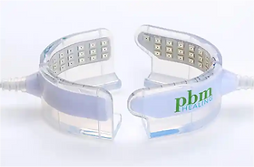 矯正加速装置 | SKYBLUE 矯正歯科・歯科