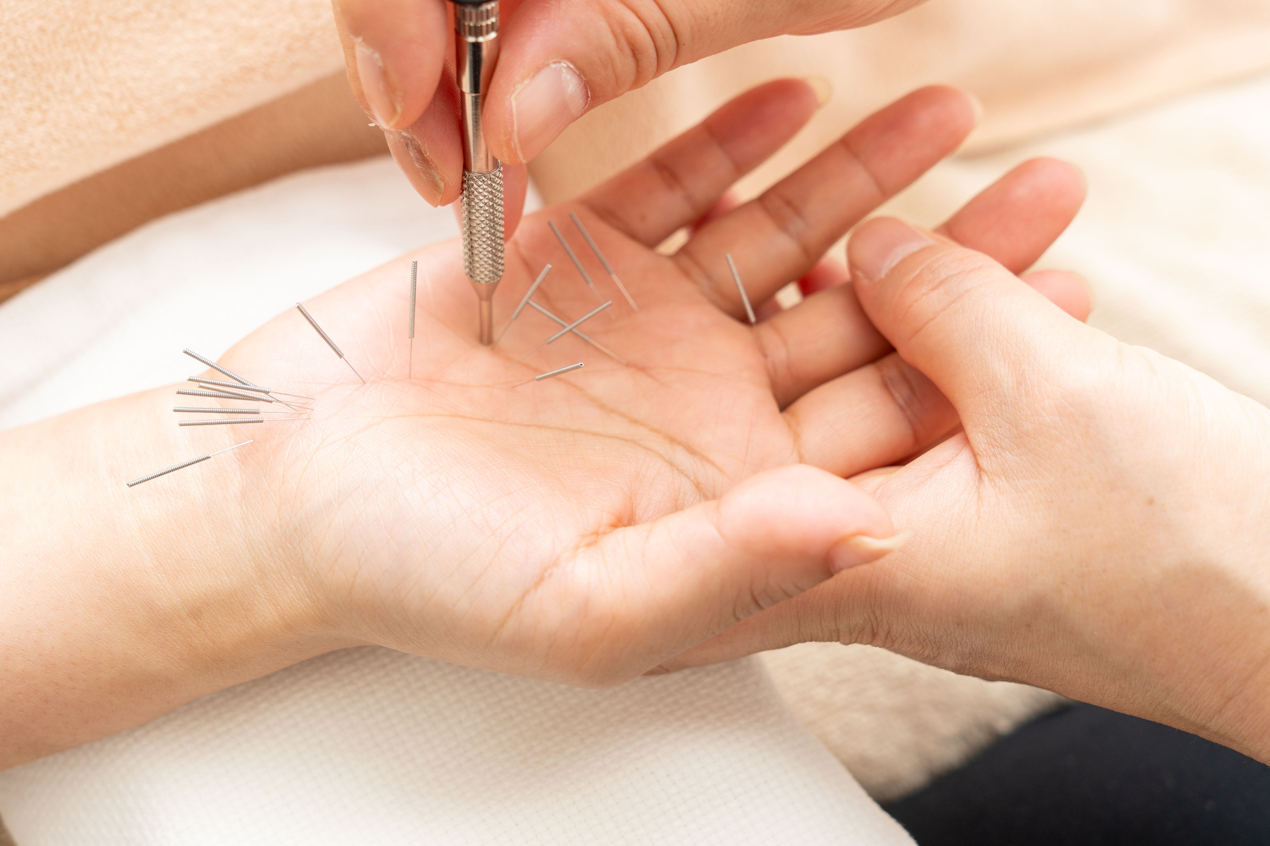 高麗手指鍼講座 手指鍼コース | 高麗鍼灸院 〜 千駄ヶ谷駅から徒歩