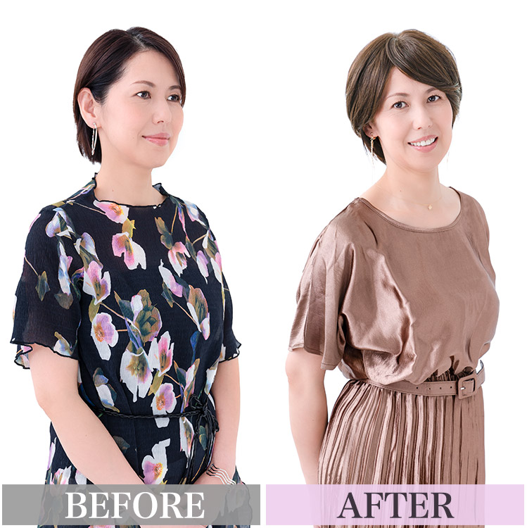 部分ウィッグ/総手植え人毛MIX6分ウィッグ リアルスキン ナチュラル