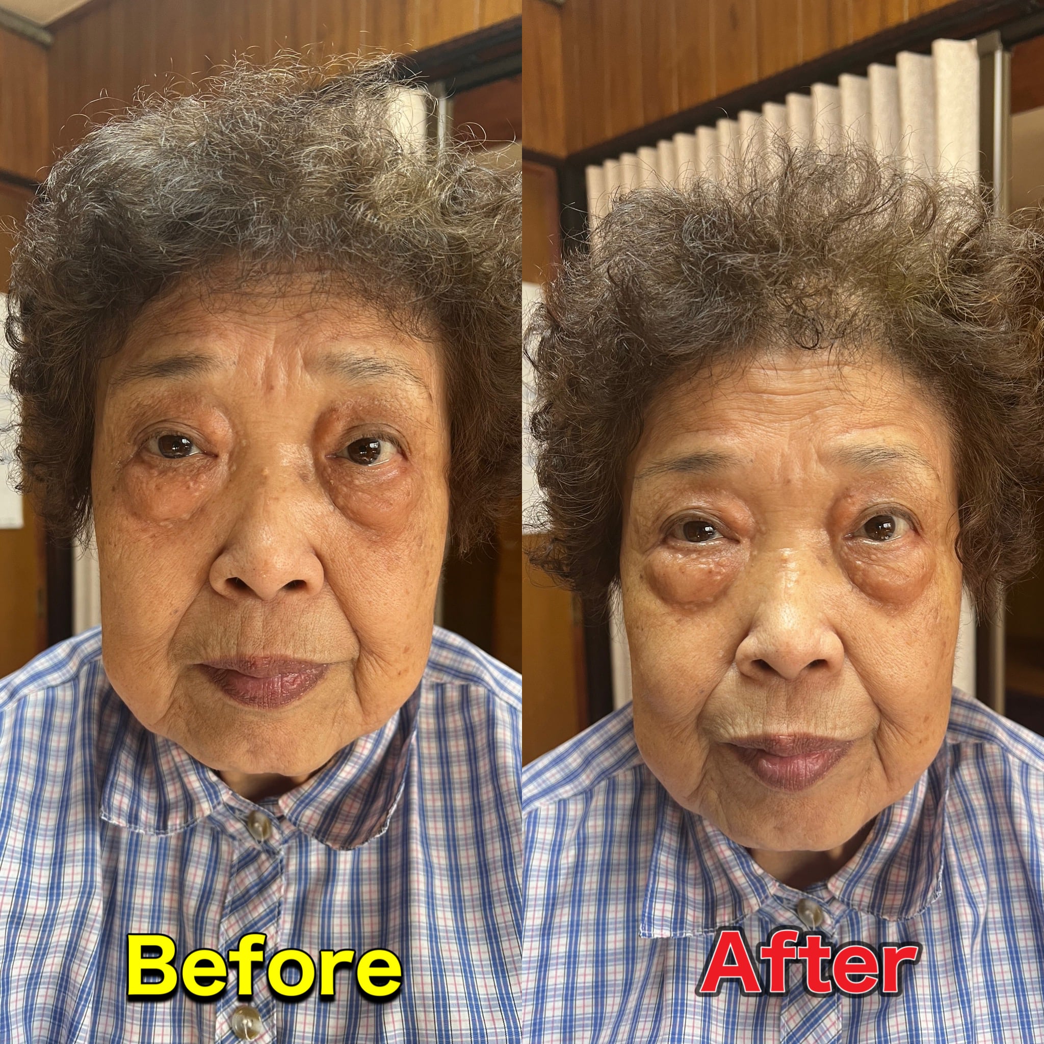 ファシアアミノジストローション チノザメソッド×ファシア | エステ