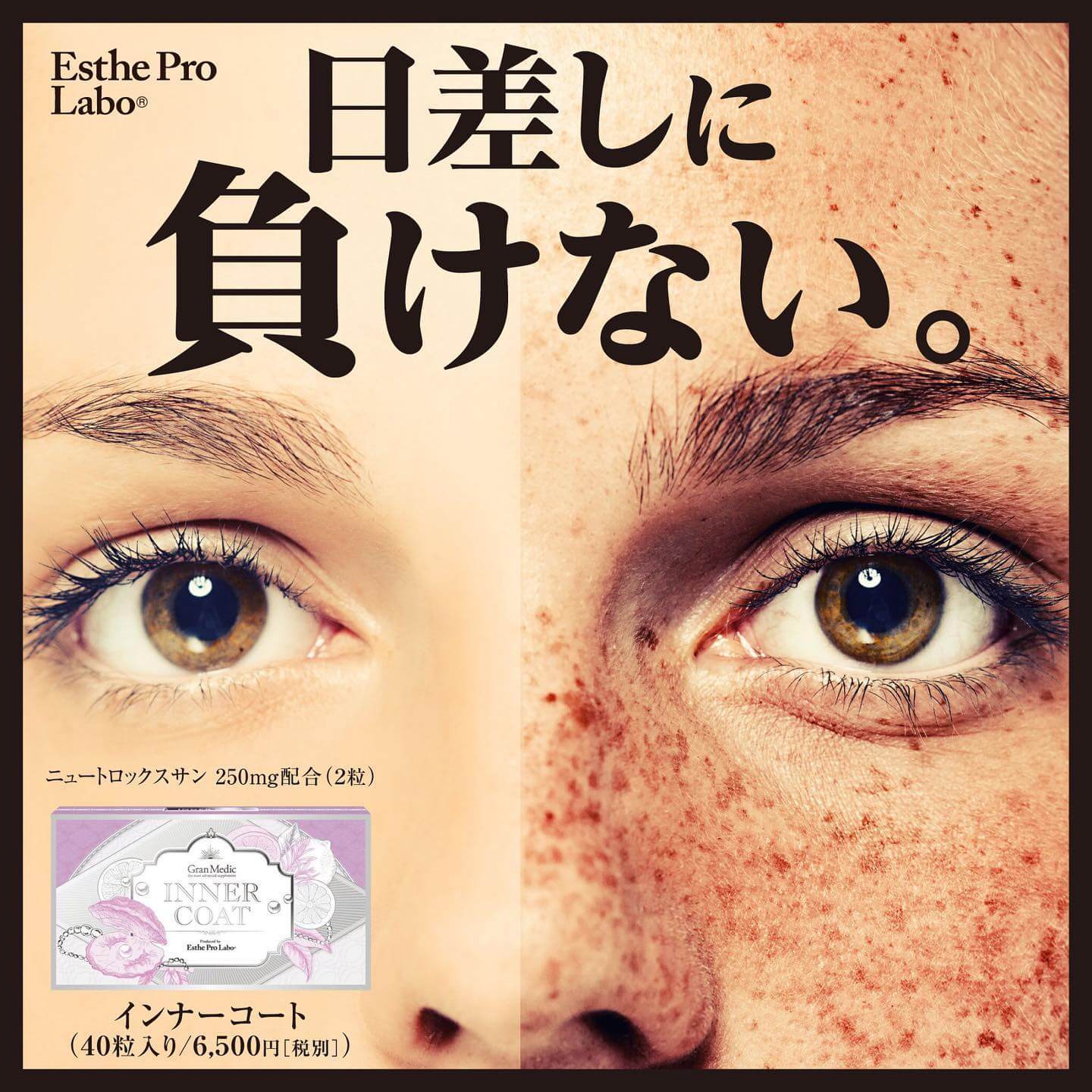 飲む日焼け止めサプリ「インナーコート」 - エステサロン・ドライ