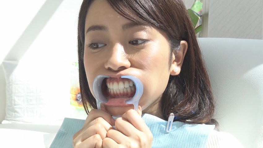 料金と回数券について | セルフホワイトニングサロンViVi