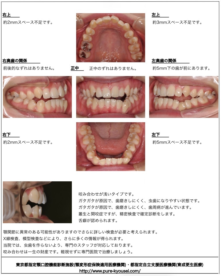 治療の流れ｜ピュア矯正歯科室｜矯正歯科治療専門｜東京都