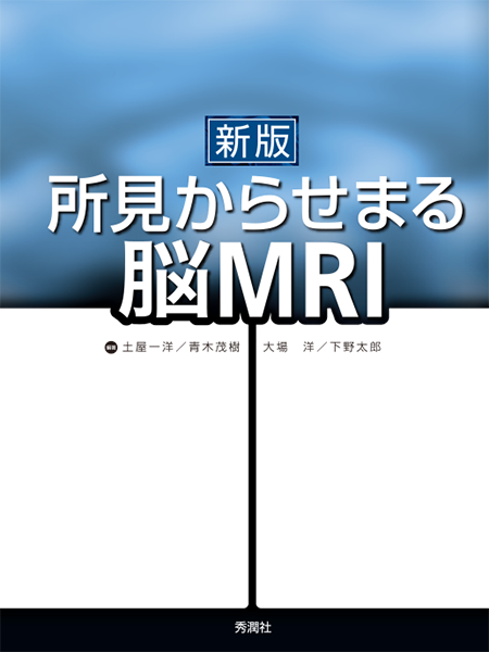 m3電子書籍 | 神経症候学 改訂第二版 Ⅱ