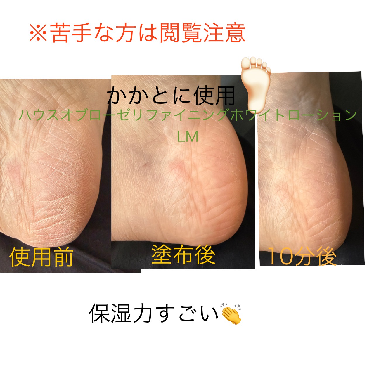 ハウス オブ ローゼ / リファイニングホワイト ローションLMの公式商品